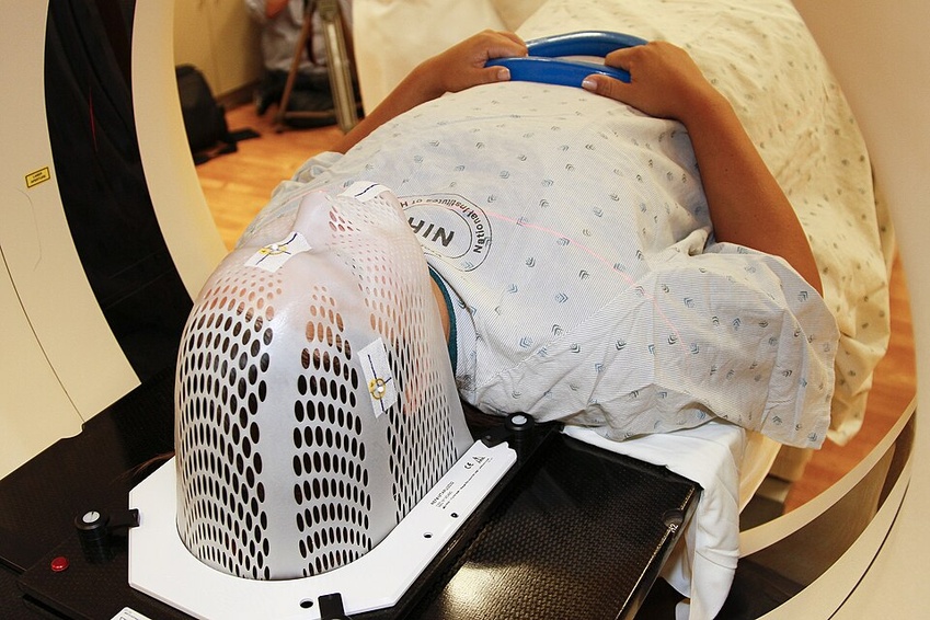Accuray and Samsung Explore Volumetric Imaging for CyberKnife Accuray and Samsung Explore Volumetric Imaging for CyberKnife