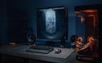 Custom Adaptive Gaming Rig Empowers Daire Gorman with Crommelin Syndrome