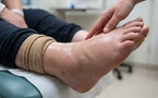 AI-Guided 4D-Printed Microneedle Patch Speeds Diabetic Wound Healing