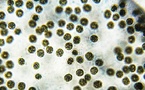 Machine Learning Boosts Biosensor Accuracy for Microcystin Detection