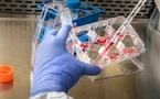 Kaigene Licenses KG006 Autoimmune Drug to Taisho for Japan