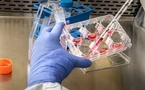 Aureka Biotechnologies Raises $100M to Advance AI Drug Discovery